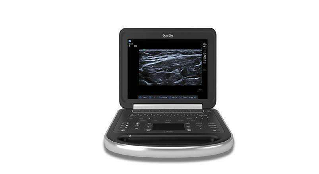 Sonosite-Edge-Portable-Ultrasound-(1).png Sonosite-Edge-Portable-Ultrasound-(1).png