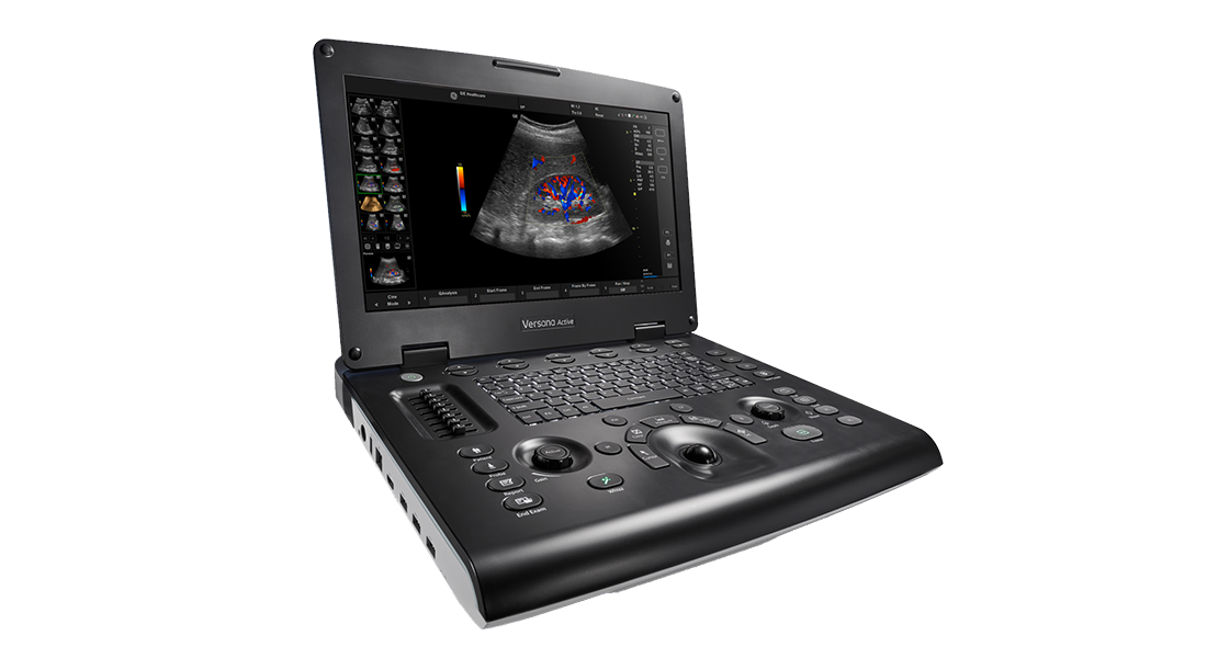 GE-Versana-Active-Ultrasound-(1).png GE-Versana-Active-Ultrasound-(1).png